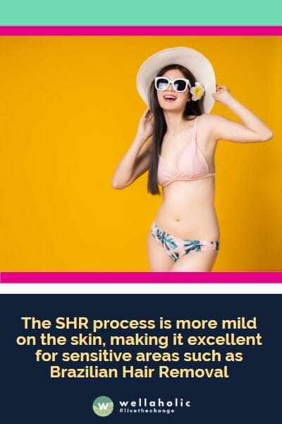 The SHR process is more mild on the skin, making it excellent for sensitive areas such as Brazilian Hair Removal