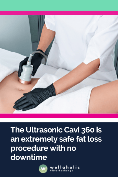 The Ultrasonic Cavi 360 is an extremely safe fat loss procedure with no downtime