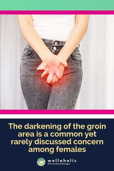 The darkening of the groin area is a common yet rarely discussed concern among females