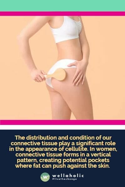 The distribution and condition of our connective tissue play a significant role in the appearance of cellulite. In women, connective tissue forms in a vertical pattern, creating potential pockets where fat can push against the skin. 