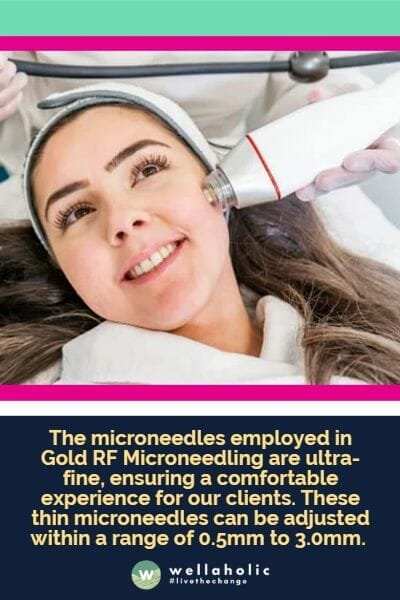 The microneedles employed in Gold RF Microneedling are ultra-fine, ensuring a comfortable experience for our clients. These thin microneedles can be adjusted within a range of 0.5mm to 3.0mm.