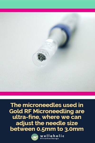 黄金RF射频微针美容中使用的微针是超细的，可以调整针尖尺寸在0.5毫米至3.0毫米之间。