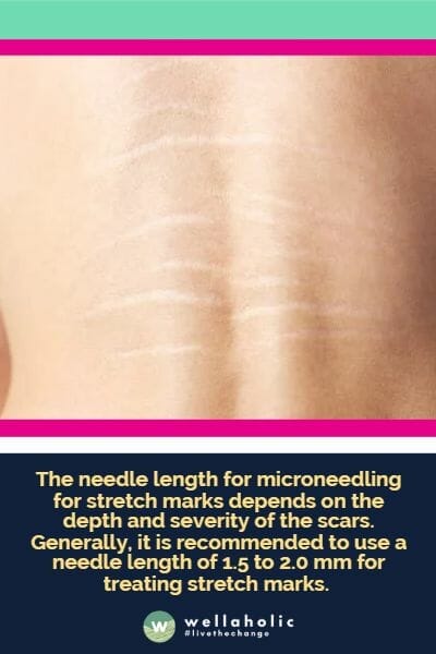 The needle length for microneedling for stretch marks depends on the depth and severity of the scars. Generally, it is recommended to use a needle length of 1.5 to 2.0 mm for treating stretch marks. 