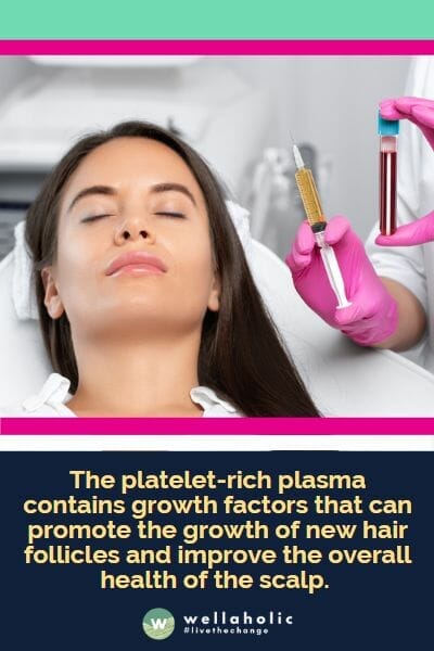 The platelet-rich plasma contains growth factors that can promote the growth of new hair follicles and improve the overall health of the scalp. 