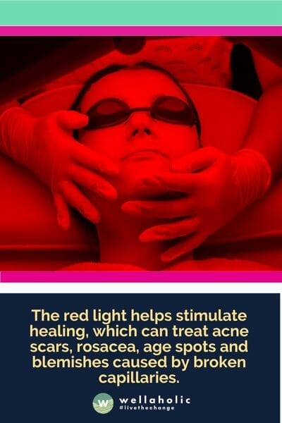 The red light helps stimulate healing, which can treat acne scars, rosacea, age spots and blemishes caused by broken capillaries.