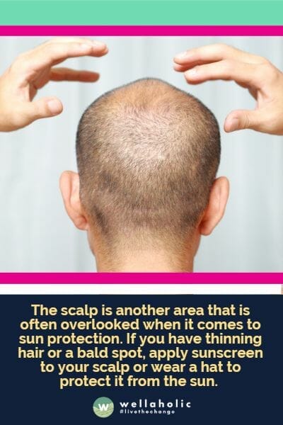 The scalp is another area that is often overlooked when it comes to sun protection. If you have thinning hair or a bald spot, apply sunscreen to your scalp or wear a hat to protect it from the sun.