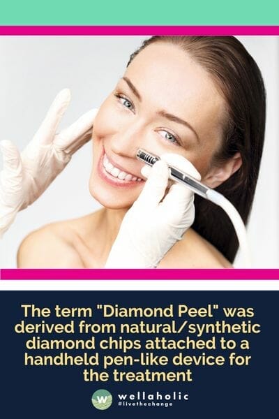 The term "Diamond Peel" was derived from natural/synthetic diamond chips attached to a handheld pen-like device for the treatment