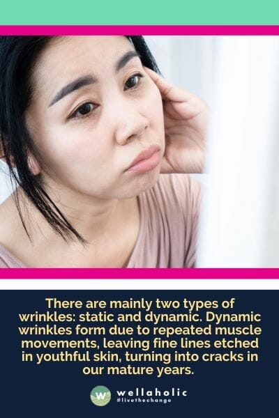 There are mainly two types of wrinkles: static and dynamic. Dynamic wrinkles form due to repeated muscle movements, leaving fine lines etched in youthful skin, turning into cracks in our mature years.