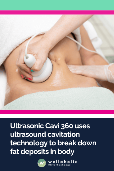 Ultrasonic Cavi 360 uses ultrasound cavitation technology to break down fat deposits in body