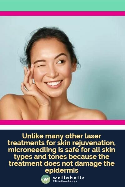 Unlike many other laser treatments for skin rejuvenation, microneedling is safe for all skin types and tones because the treatment does not damage the epidermis