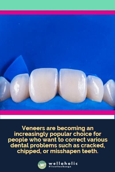 Veneers are becoming an increasingly popular choice for people who want to correct various dental problems such as cracked, chipped, or misshapen teeth.
