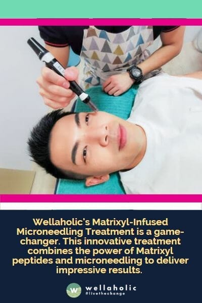 Wellaholic的Matrixyl注入微针疗程是一个颠覆者。这项创新性治疗结合了Matrixyl肽和微针技术的力量，以提供令人印象深刻的效果。
