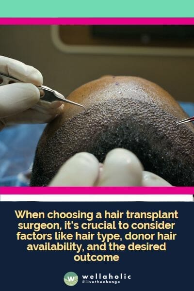When choosing a hair transplant surgeon, it's crucial to consider factors like hair type, donor hair availability, and the desired outcome