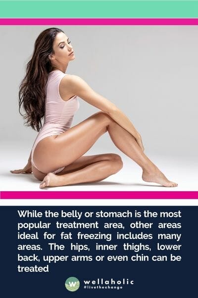 While the belly or stomach is the most popular treatment area, other areas ideal for fat freezing includes many areas. The hips, inner thighs, lower back, upper arms or even chin can be treated