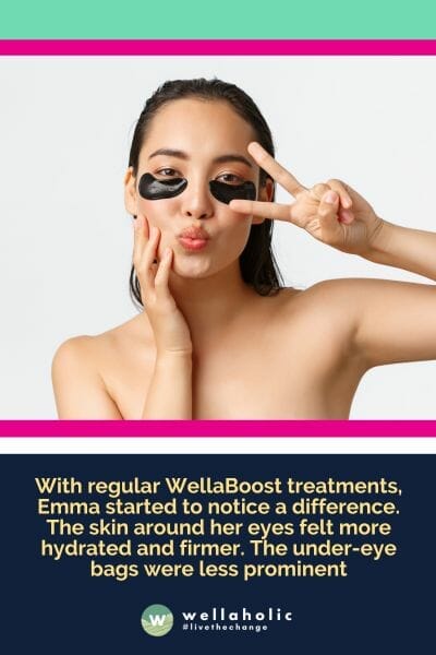 With regular WellaBoost treatments, Emma started to notice a difference. The skin around her eyes felt more hydrated and firmer. The under-eye bags were less prominent