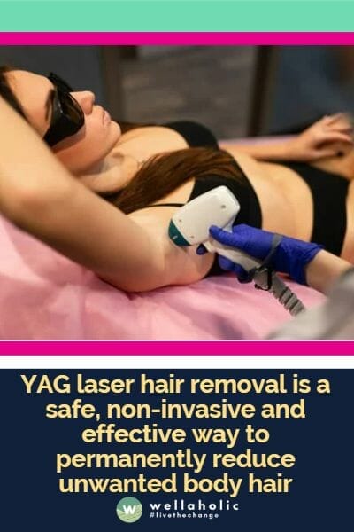 Nd: YAG激光是脱毛世界中精通科技的福尔摩斯，它通过高能脉冲光勤勉地寻找并消灭顽固的毛囊。这种光被毛发中的色素吸收，然后激光的热能关闭了毛囊的生长机制。可能需要一系列令人激动的、除毛的剧集，其数量根据皮肤类型、毛发类型和所涉及的区域而变化。