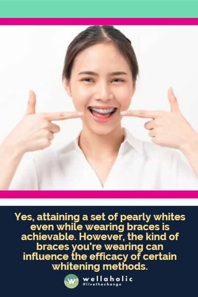 Yes, attaining a set of pearly whites even while wearing braces is achievable. However, the kind of braces you're wearing can influence the efficacy of certain whitening methods.