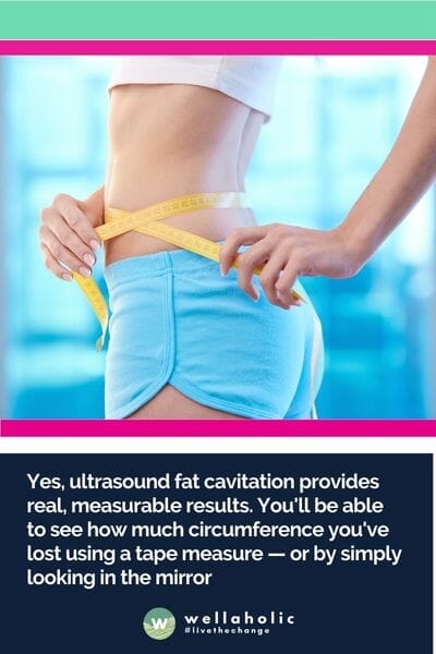 Yes, ultrasound fat cavitation provides real, measurable results. You'll be able to see how much circumference you've lost using a tape measure — or by simply looking in the mirror