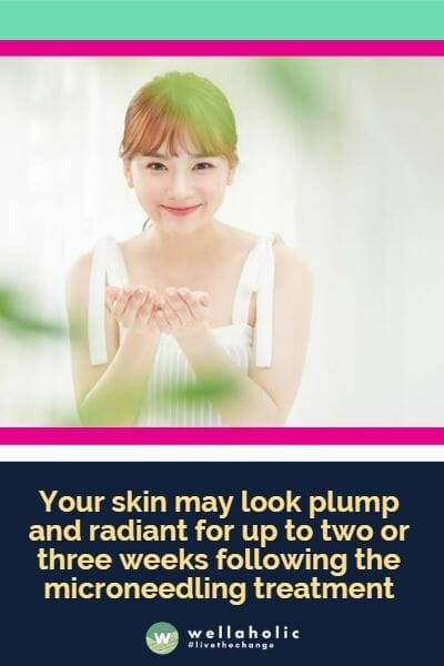 在进行微针疗程后，您的皮肤可能会在接下来的两到三周内显得丰盈和光彩照人。