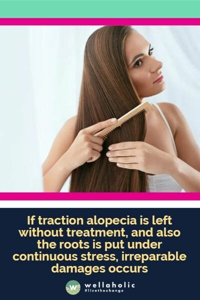 if traction alopecia is left without treatment, and also the roots is put under continuous stress, irreparable damages occurs