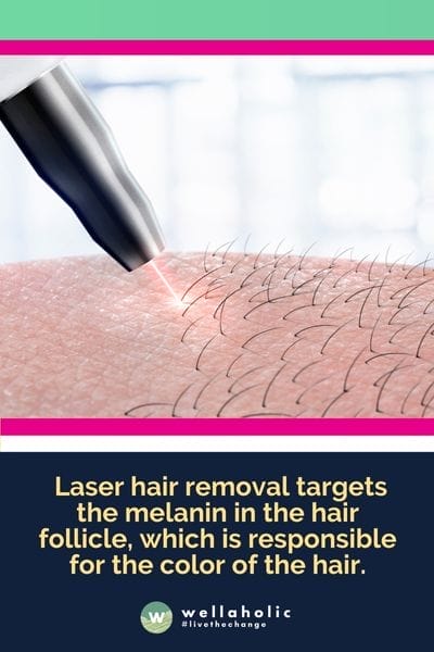  laser hair removal targets the melanin in the hair follicle, which is responsible for the color of the hair.