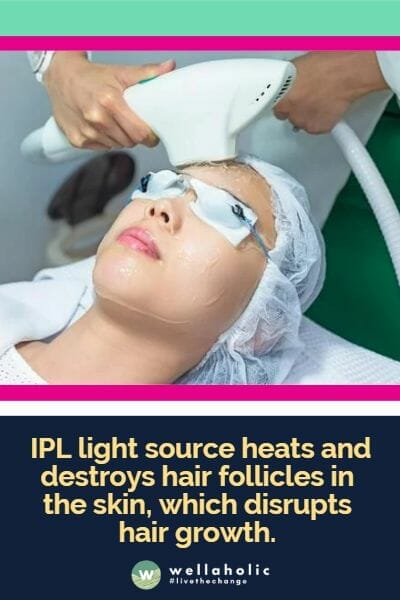  light source heats and destroys hair follicles in the skin, which disrupts hair growth.