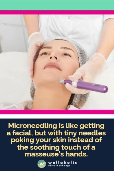 like getting a facial, but with tiny needles poking your skin instead of the soothing touch of a masseuse's hands.