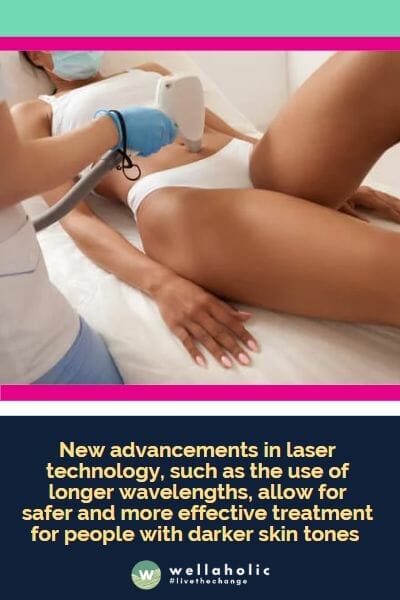 激光技术的新进展，如使用更长波长，使得对于皮肤较深色调的人们来说，治疗更加安全和有效。