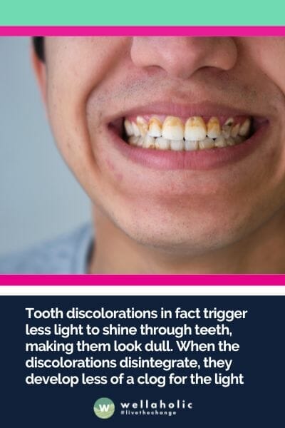 ooth discolorations in fact trigger less light to shine through teeth, making them look dull. When the discolorations disintegrate, they develop less of a clog for the light.