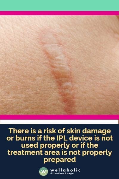 there is a risk of skin damage or burns if the IPL device is not used properly or if the treatment area is not properly prepared