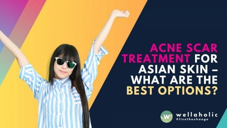 Acne Scar Treatment for Asian Skin – What Are the Best Options?