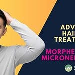Discover advanced hair loss treatments with Morpheus8 RF microneedling for effective hair restoration and scalp treatment. Say goodbye to hair loss!