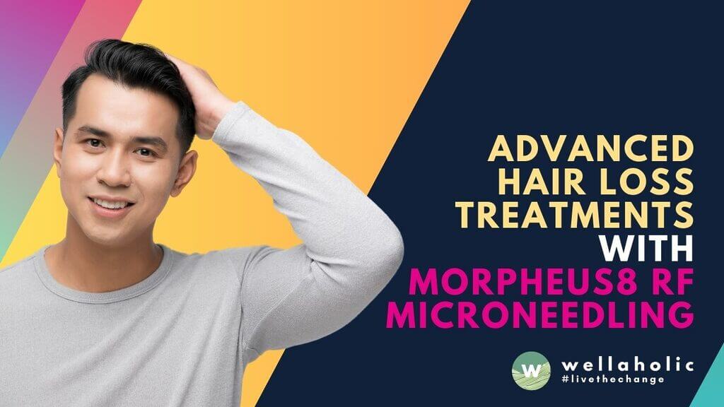 Discover advanced hair loss treatments with Morpheus8 RF microneedling for effective hair restoration and scalp treatment. Say goodbye to hair loss!