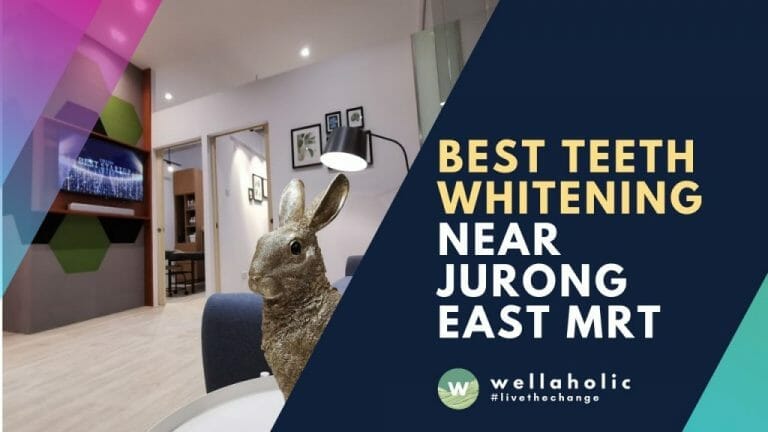 Best Teeth Whitening Jurong East MRT
