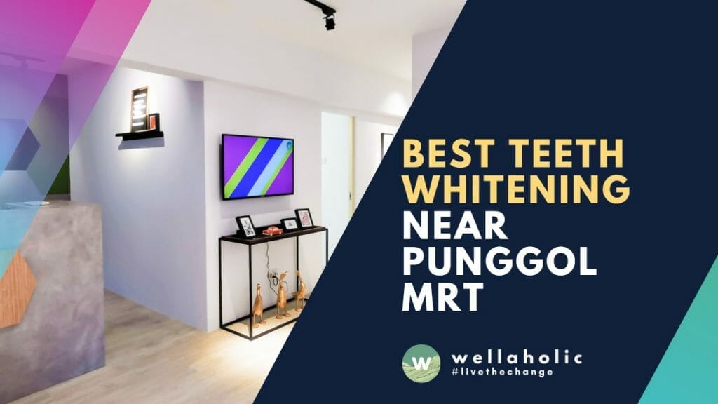 Best Teeth Whitening Service near Punggol MRT
