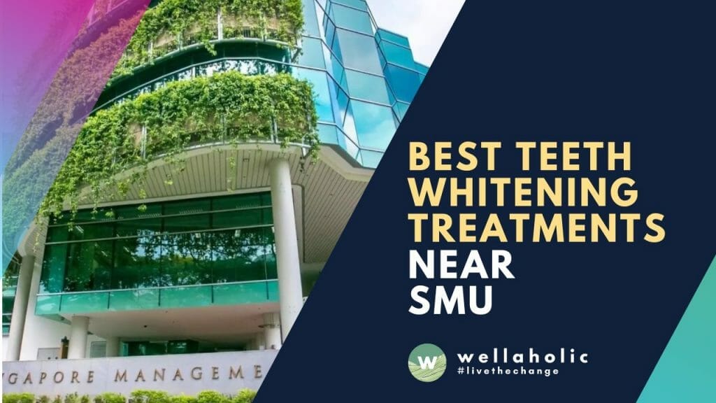 Best Teeth Whitening near SMU