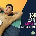 Discover the truth about targeted fat loss with laser lipo. Learn about the procedure, results, and whether it can truly spot-reduce fat.
