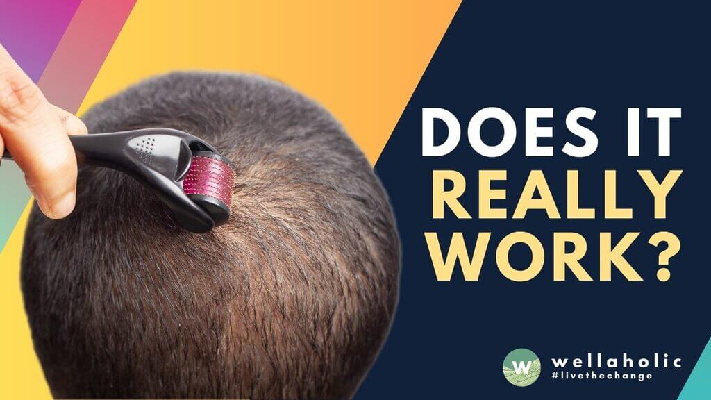 Determined to get a fuller head of hair? Find out if microneedling for the scalp is an effective option for treating hair loss right here!