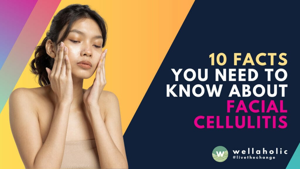 Discover the 10 essential facts about facial cellulitis that every Singaporean should know. From symptoms and causes to treatment options, this comprehensive guide empowers you to take control of your skin health. Read on to become an informed wellness enthusiast.