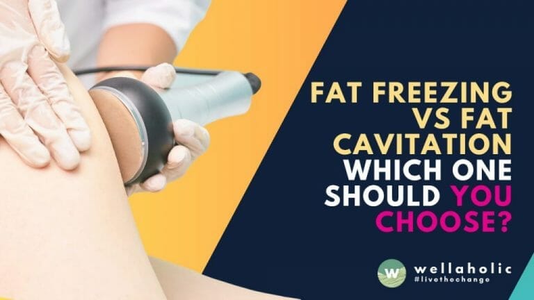 Fat freezing vs fat cavitation: Which one should you choose?