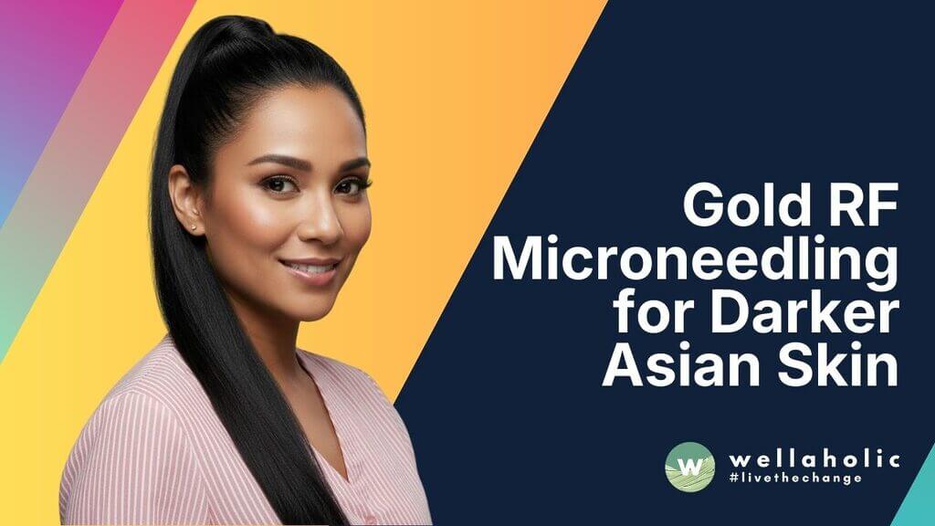 Gold RF Microneedling for Darker Asian Skin: Is It Safe? (Singapore Evidence)