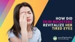 Discover the magic of skin boosters revitalizing tired eyes! Say goodbye to dark circles and puffiness and embrace youthful, refreshed eyes. Explore the power of skin boosters to rejuvenate the delicate eye area. Witness the transformation and get ready to embrace a brighter, more vibrant look