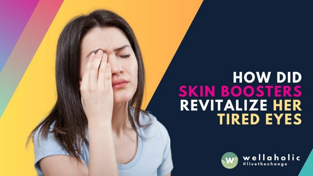 Discover the magic of skin boosters revitalizing tired eyes! Say goodbye to dark circles and puffiness and embrace youthful, refreshed eyes. Explore the power of skin boosters to rejuvenate the delicate eye area. Witness the transformation and get ready to embrace a brighter, more vibrant look