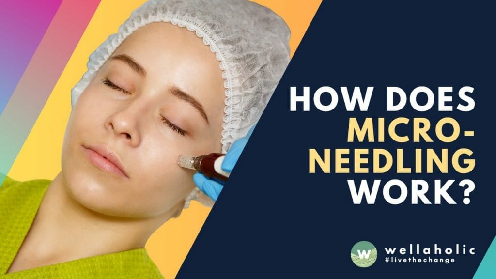 Unravel the science behind microneedling, a transformative skincare procedure! Discover how this technique can revolutionize your skin's health and appearance. Embrace the magic of microneedling today