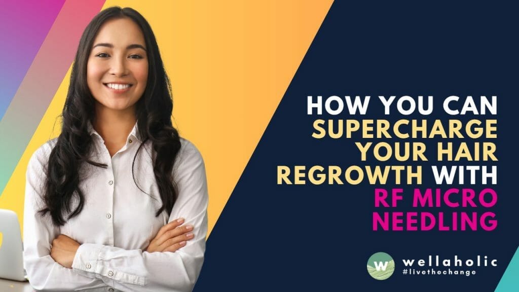 How You Can Supercharge Your Hair Regrowth with RF Microneedling