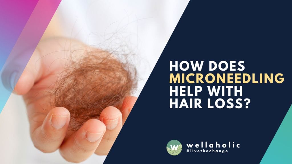 How does microneedling help with hair loss