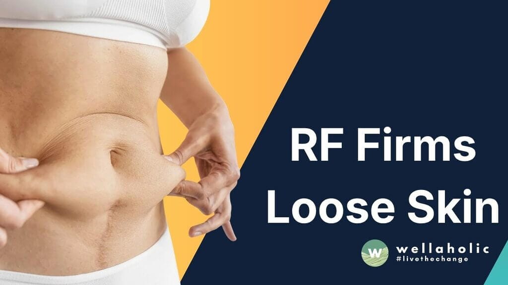 Wellaholic Blog How to Firm Loose Skin Singapore 5 Proven RF Methods