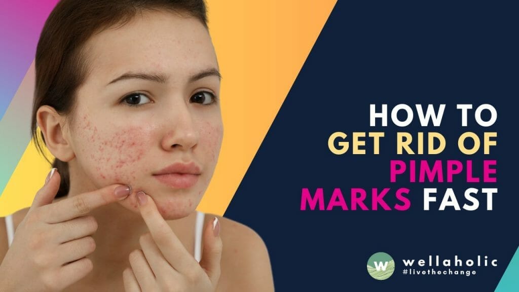How To Get Rid of Pimple Marks Fast