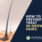 How to prevent and treat ingrown hairs