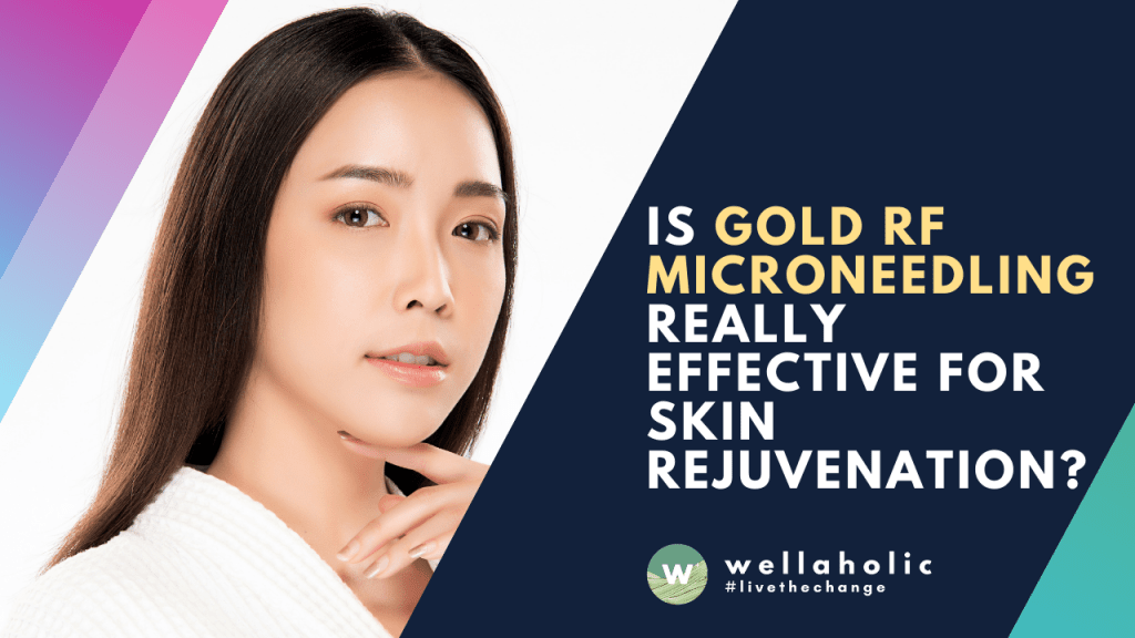 Is Gold RF Microneedling Really Effective for Skin Rejuvenation
